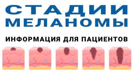 Стадии меланомы