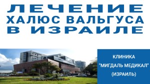 лечение халюс вальгуса в израиле