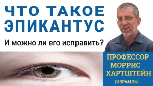 Что такое эпикантус